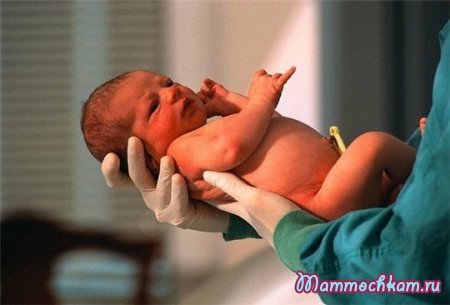 Форма головы новорожденного ребенка